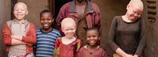 Chinese Scientists Develop Drug That Could Extend Human Lifespan To 150 Years — New York Times