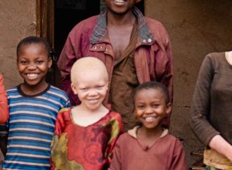Challenges And Solutions To Albinism In Nigeria: A Call For Awareness, Protection, And Empowerment – OHI