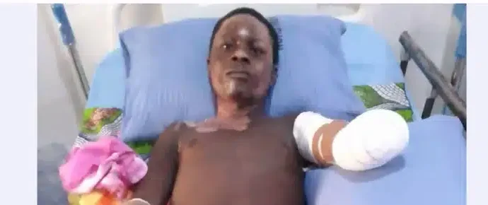 Tragedy Strikes As Taraba Polytechnic Student Loses Both Hands In Electrocution Accident